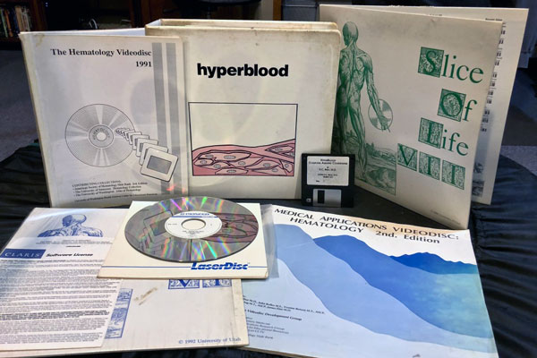 (Courtesy of Suzanne Stensaas) Some of the LaserVision videodiscs and Slice of Life materials that Paul Burrows created.